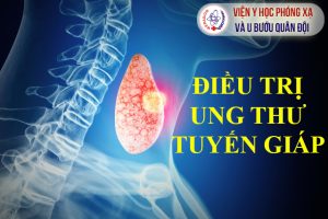 Điều trị ung thư tuyến giáp thể biệt hóa